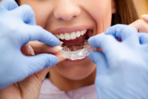 orthodontics for adults